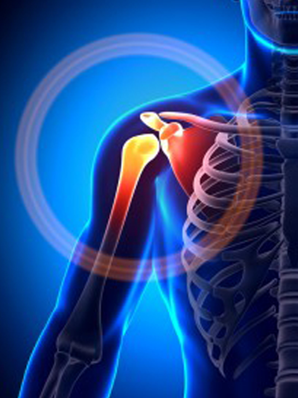 arthritis-shoulder